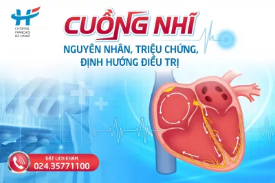 Cuồng nhĩ: Nguyên nhân, triệu chứng và định hướng điều trị